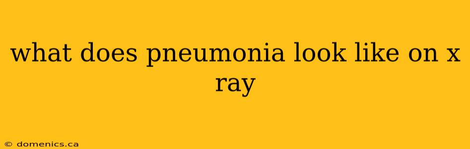 what does pneumonia look like on x ray