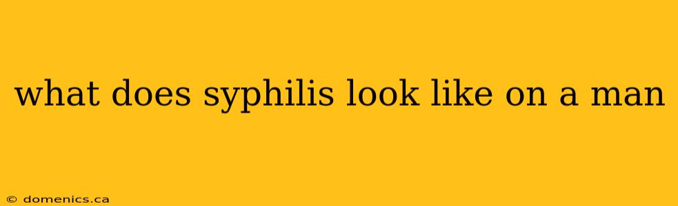 what does syphilis look like on a man