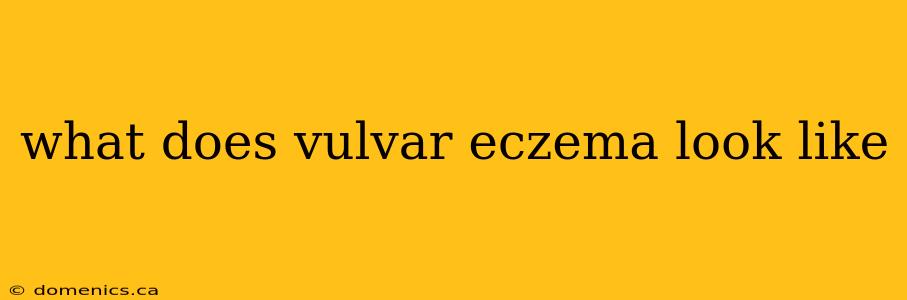 what does vulvar eczema look like