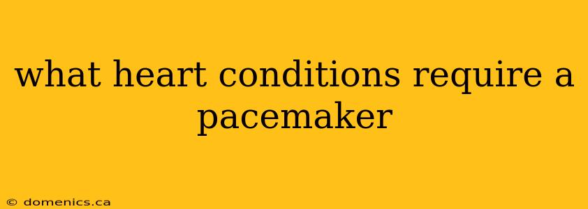 what heart conditions require a pacemaker