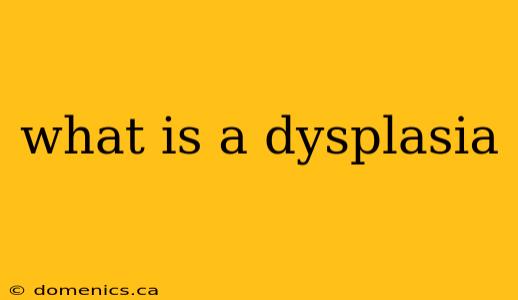 what is a dysplasia