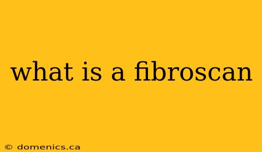 what is a fibroscan