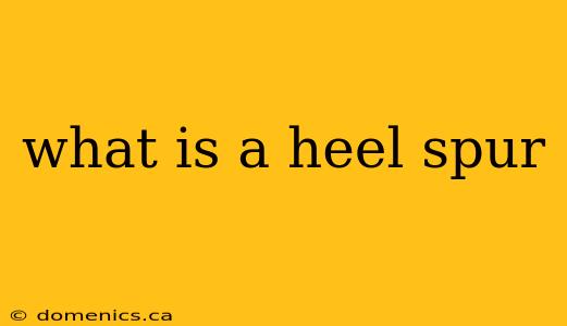 what is a heel spur