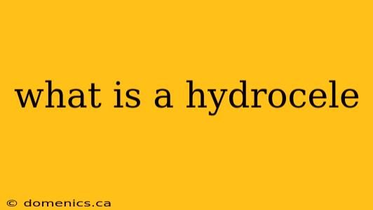 what is a hydrocele