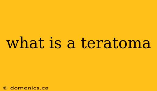 what is a teratoma