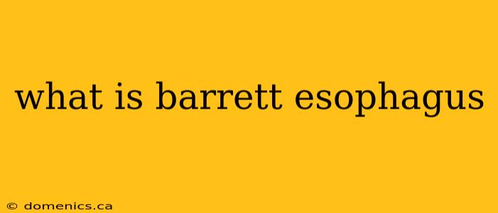 what is barrett esophagus