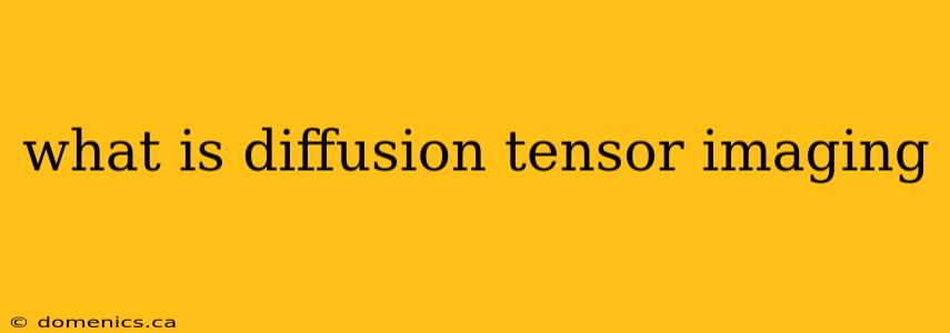 what is diffusion tensor imaging