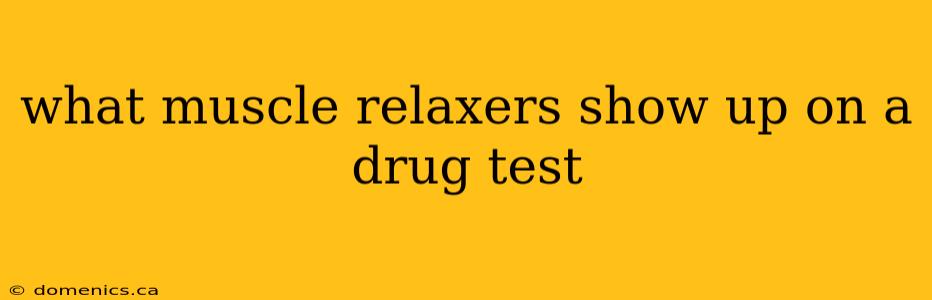 what muscle relaxers show up on a drug test