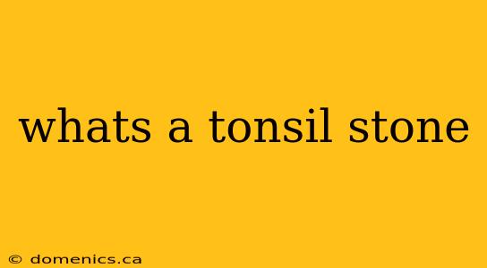 whats a tonsil stone