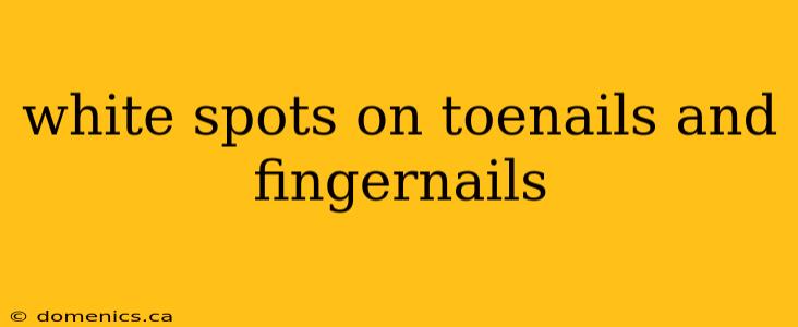 white spots on toenails and fingernails