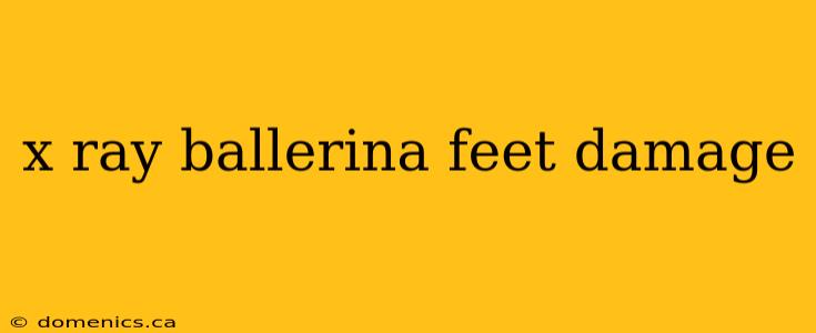 x ray ballerina feet damage